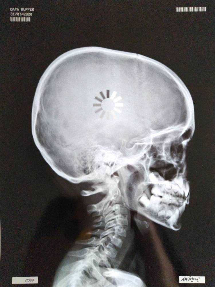 Imbue, ‘Data Buffer’, 2020, Print, X Ray on glossy paper, Imbue Source, Numbered