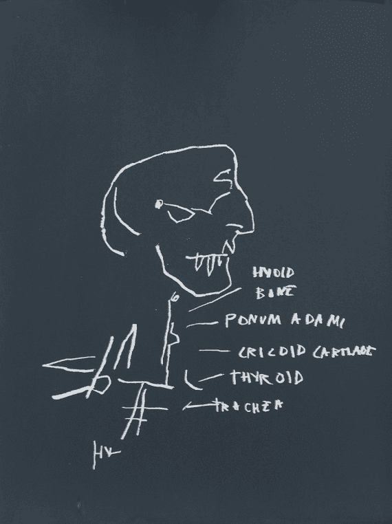 Jean-Michel Basquiat, ‘Thyroid’, 1982, Print, Screenprint on Arches 88 paper, null, Numbered