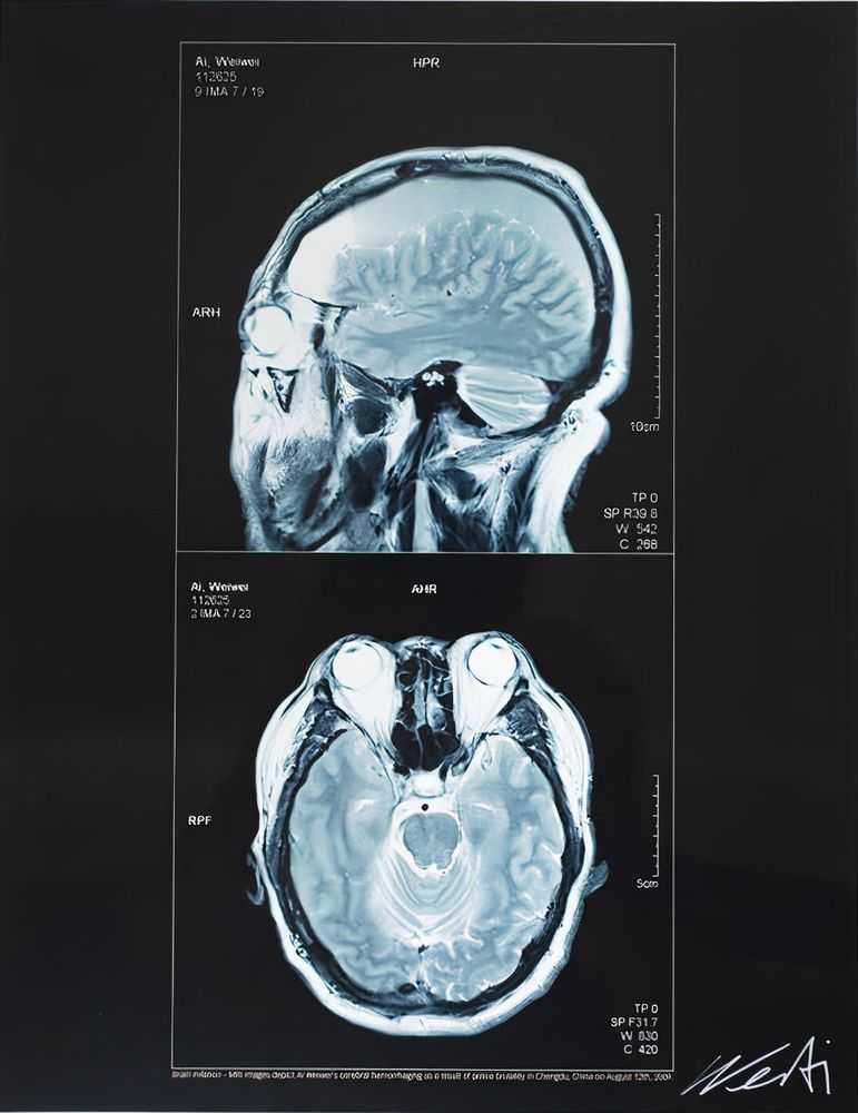 Ai Weiwei, ‘Brain Inflation’, 31-08-2021, Print, Print on Light Jet Fuji Flex High Gloss, Cahier D'Art, Numbered