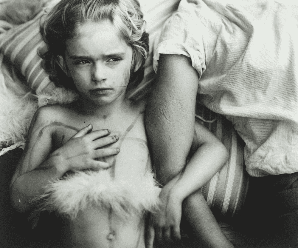 Sally Mann, ‘Jessie Bites’, 1985, Print, Gelatin silver print, null, Numbered, Dated