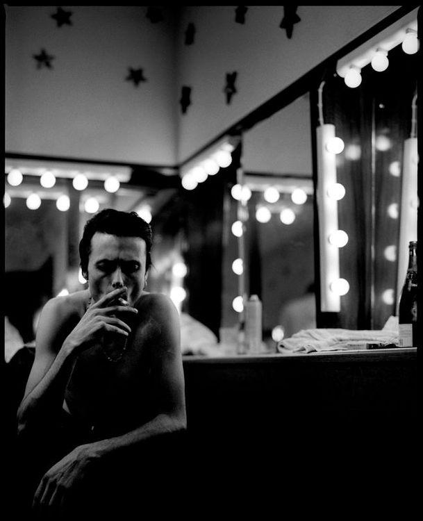 Brett Anderson